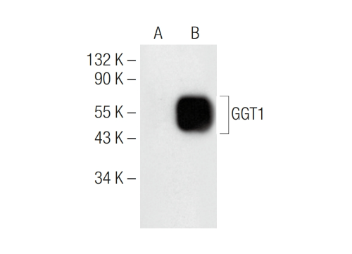 GGT1 Mouse Monoclonal Antibody (F-7)