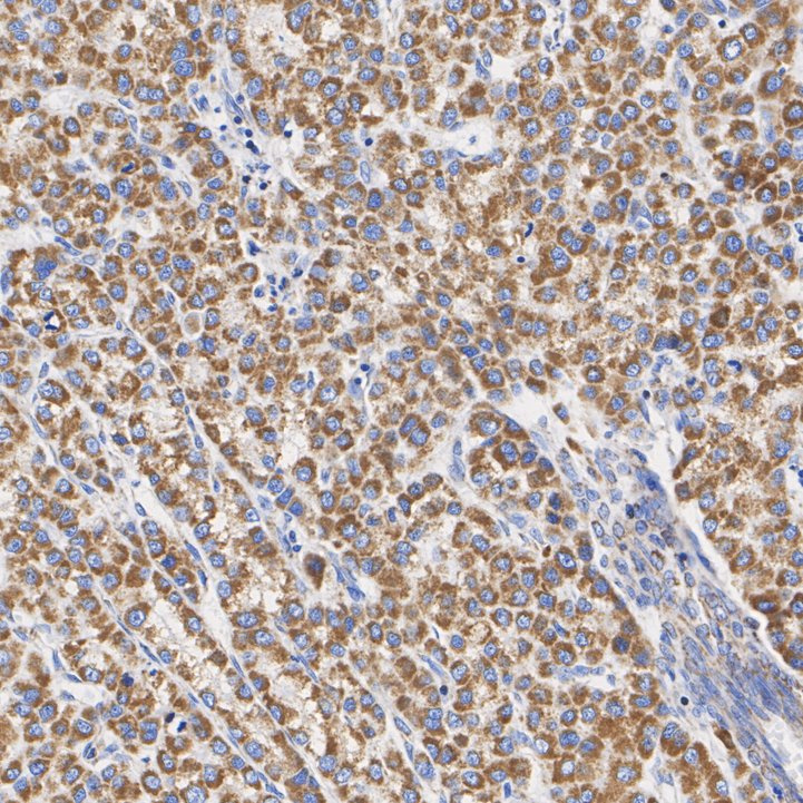 SDHB Rabbit Monoclonal Antibody(ARA641)