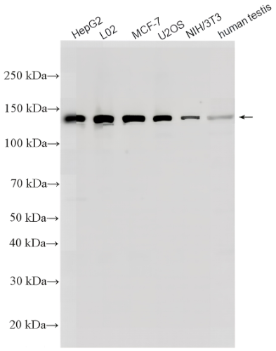 VCPIP1 Rabbit Polyclonal Antibody