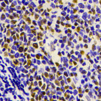 Myb Rabbit Monoclonal Antibody(ARA653)