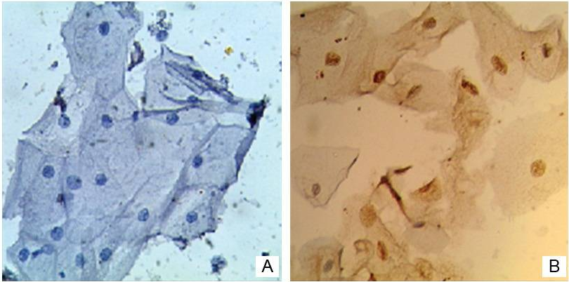 HPV16 E6/18 E6 Mouse Monoclonal Antibody(ARA659)