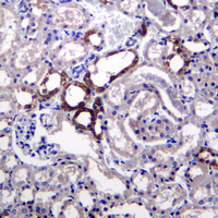 KRAS Rabbit Monoclonal Antibody(ARA666)