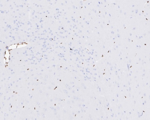 FOXC1 Rabbit Monoclonal Antibody(ARA672)