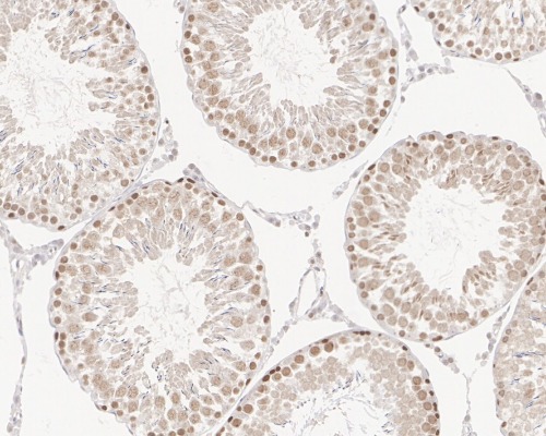 POLD1 Rabbit Monoclonal Antibody(ARA680)