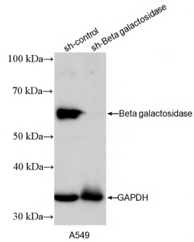 Beta galactosidase Rabbit Monoclonal Antibody(ARA681)