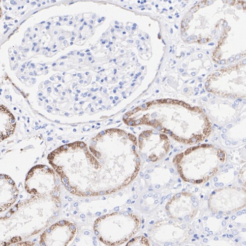 CXCL12/SDF1 Rabbit Monoclonal Antibody(ARA682)