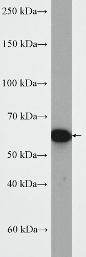 Serpina3k Rabbit Polyclonal Antibody