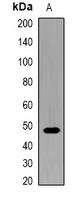 CD47 Rabbit Polyclonal Antibody