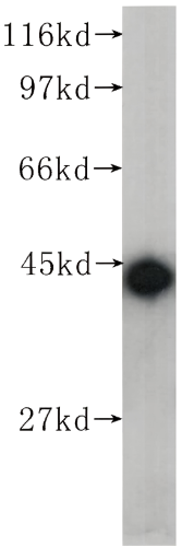 Beta Actin Mouse Monoclonal antibody(ARA711)