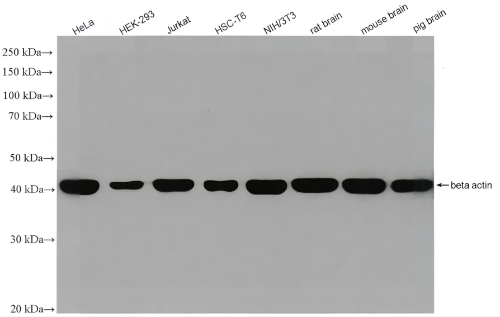 Beta Actin Rabbit Monoclonal antibody(ARA710)