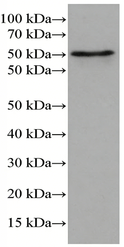 C9RANT Mouse Monoclonal Antibody(ARA714)