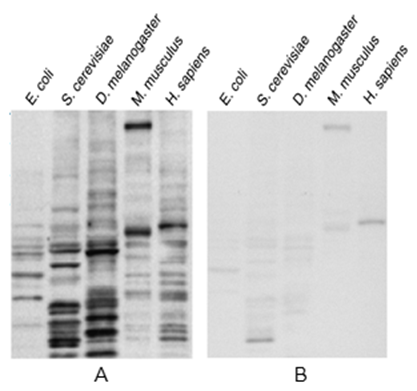 Succinyllysine Rabbit Polyclonal Antibody