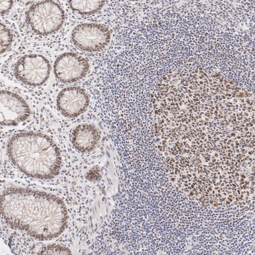 MLH1 Mouse Monoclonal Antibody(ARA721)