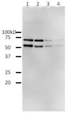 HIV1 Reverse transcriptase Rabbit Polyclonal Antibody