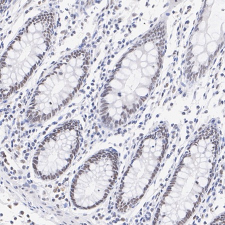 MLH1 Rabbit Monoclonal Antibody(ARA726)