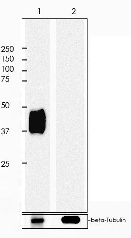 PD-L1 Rabbit Monoclonal Antibody(ARA730)