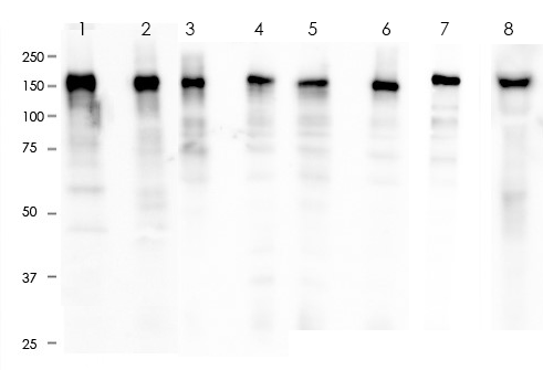 EGFR Rabbit Monoclonal Antibody(ARA731)
