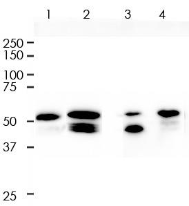 Vimentin Rabbit Monoclonal Antibody(ARA732)