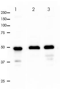 Beta III tubulin Rabbit Monoclonal Antibody(ARA733)