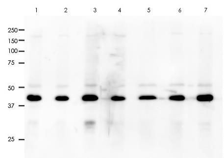 Alpha smooth muscle actin (&alpha;-SMA) Rabbit Monoclonal Antibody(ARA734)