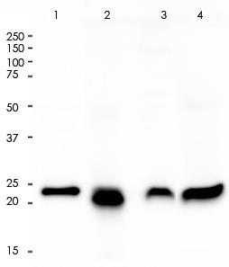 MGMT Rabbit Monoclonal Antibody(ARA735)