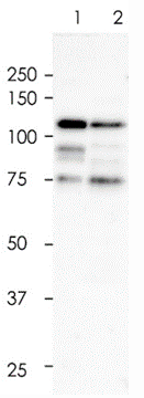 E-Cadherin Rabbit Monoclonal Antibody(ARA737)