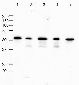 Vimentin Rabbit Monoclonal Antibody(ARA738)