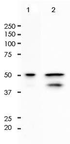 Cytokeratin 8 Rabbit Monoclonal Antibody(ARA739)