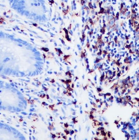 CD20 Rabbit Monoclonal Antibody(ARA740)