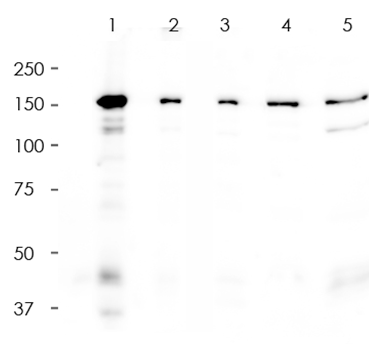 MSH6 Rabbit Monoclonal Antibody(ARA741)