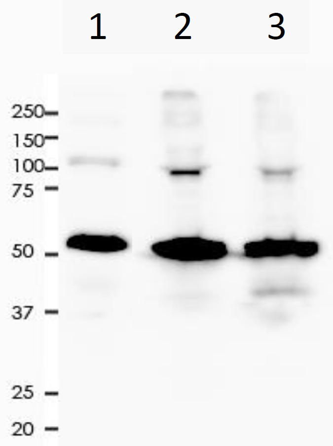 Desmin Rabbit Monoclonal Antibody(ARA742)