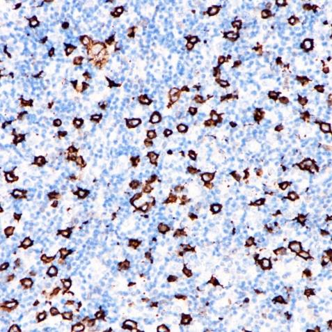 CD30 Rabbit Monoclonal Antibody(ARA743)