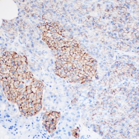 CD99 Rabbit Monoclonal Antibody(ARA744)