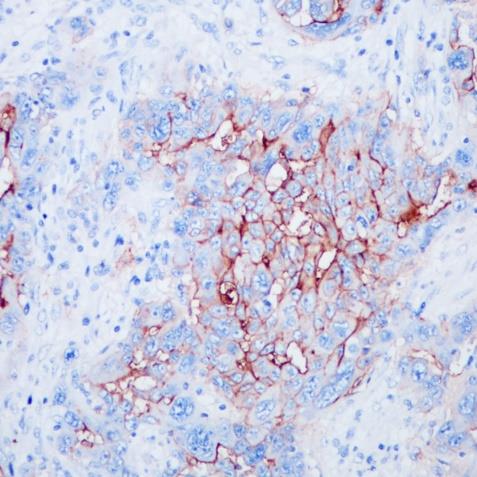 MUC16/CA125 Rabbit Monoclonal Antibody(ARA745)