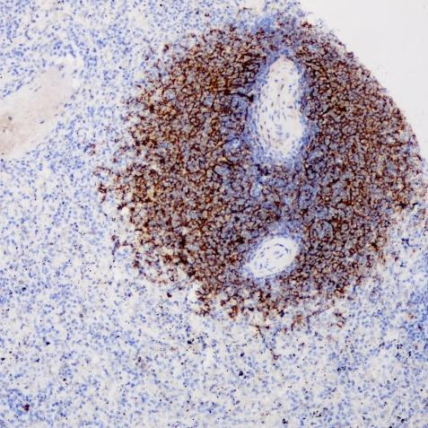 CD21 Rabbit Monoclonal Antibody(ARA746)