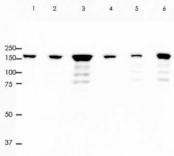 TOPO II Rabbit Monoclonal Antibody(ARA747)