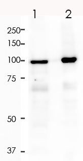 Androgen Receptor Rabbit Monoclonal Antibody(ARA748)