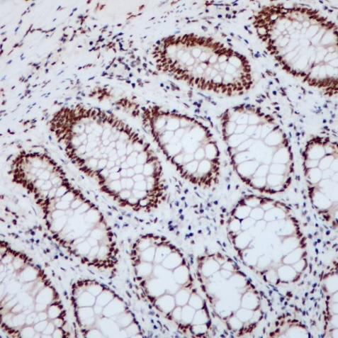 MLH1 Rabbit Monoclonal Antibody(ARA749)