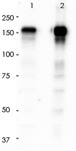 EGFR Rabbit Monoclonal Antibody(ARA750)