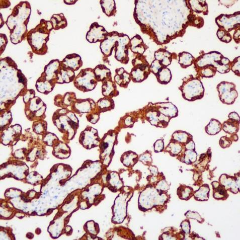 S100P Rabbit Monoclonal Antibody(ARA751)