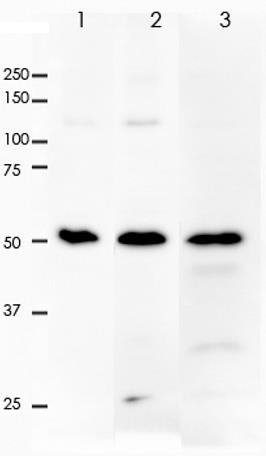 p53 Rabbit Monoclonal Antibody(ARA752)