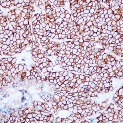 HER-2 Rabbit Monoclonal Antibody(ARA753)
