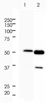Cytokeratin 5 Rabbit Monoclonal Antibody(ARA755)