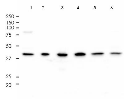 Alpha smooth muscle Actin Rabbit Monoclonal Antibody(ARA756)