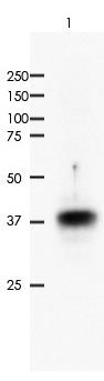 CDX2 Rabbit Monoclonal Antibody(ARA757)