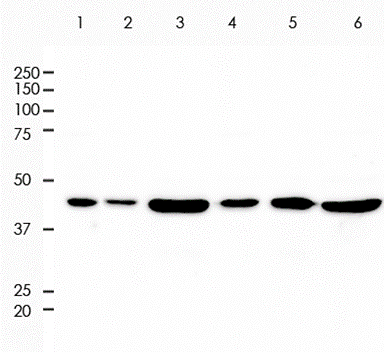 Alpha Actin 2 Rabbit Monoclonal Antibody(ARA760)