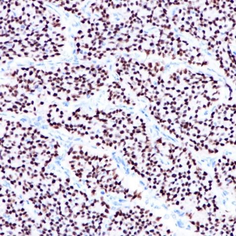 ER alpha Rabbit Monoclonal Antibody(ARA761)