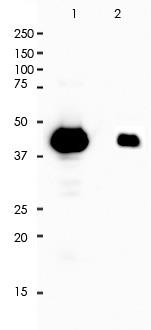 Cytokeratin 20 Rabbit Monoclonal Antibody(ARA763)