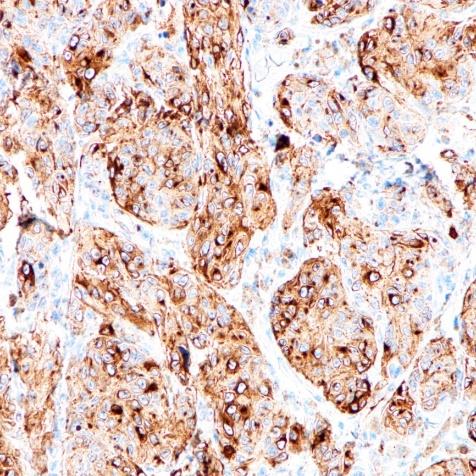 PMEL 17 Rabbit Monoclonal Antibody(ARA764)