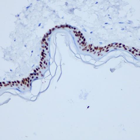 P40 Rabbit Monoclonal Antibody(ARA766)